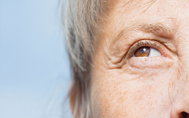 Elderly women's eye